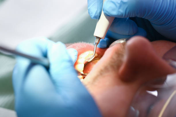 Best Weekend Emergency Dentist in Mount Vernon, KY