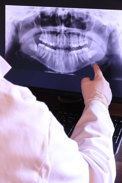 Best Emergency Wisdom Teeth Removal in Mount Vernon, KY