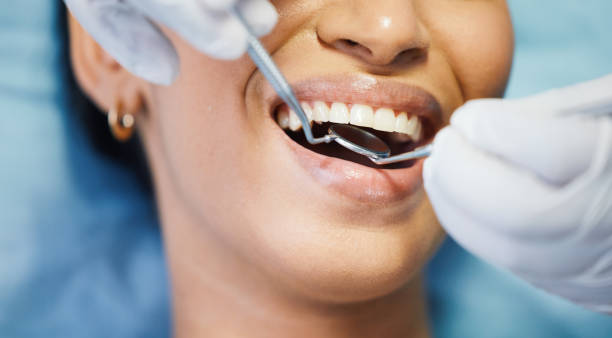 Best Emergency Broken Tooth Repair in Mount Vernon, KY